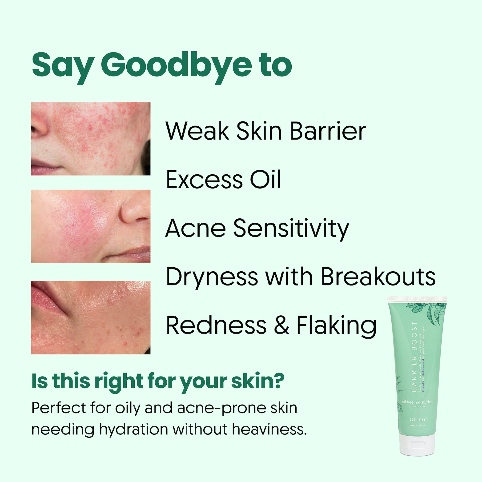 Barrier Boost Oil Free Moisturizer