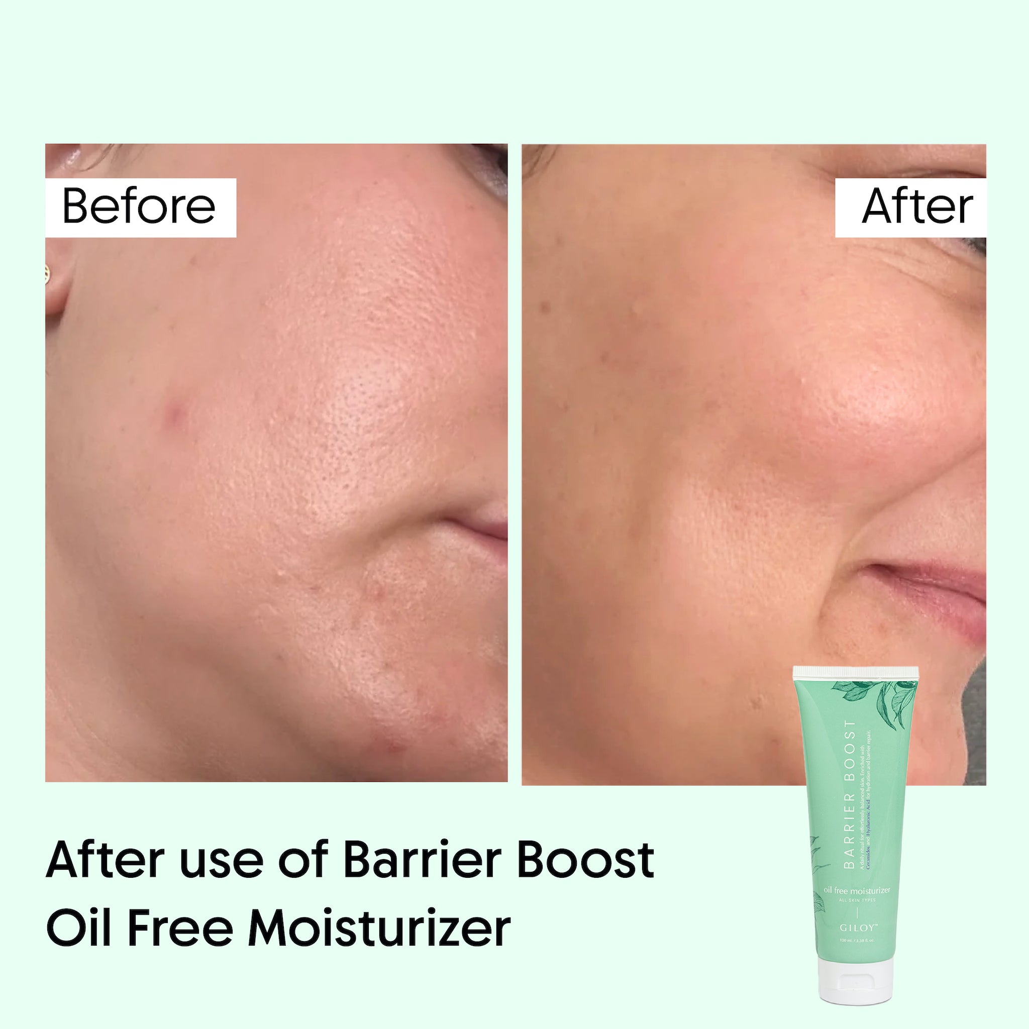 Barrier Boost Oil Free Moisturizer
