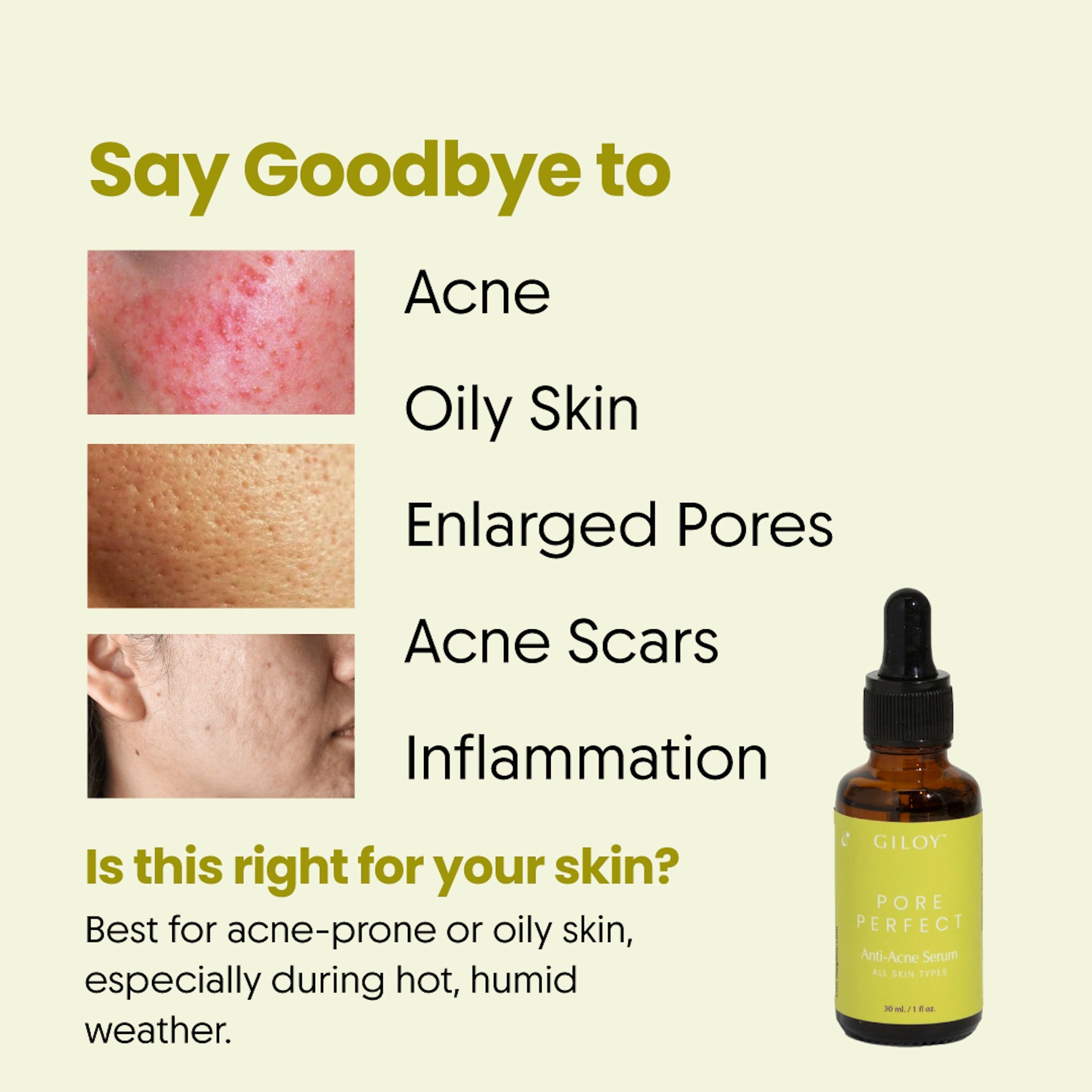 Pore Perfect Anti-Acne Serum