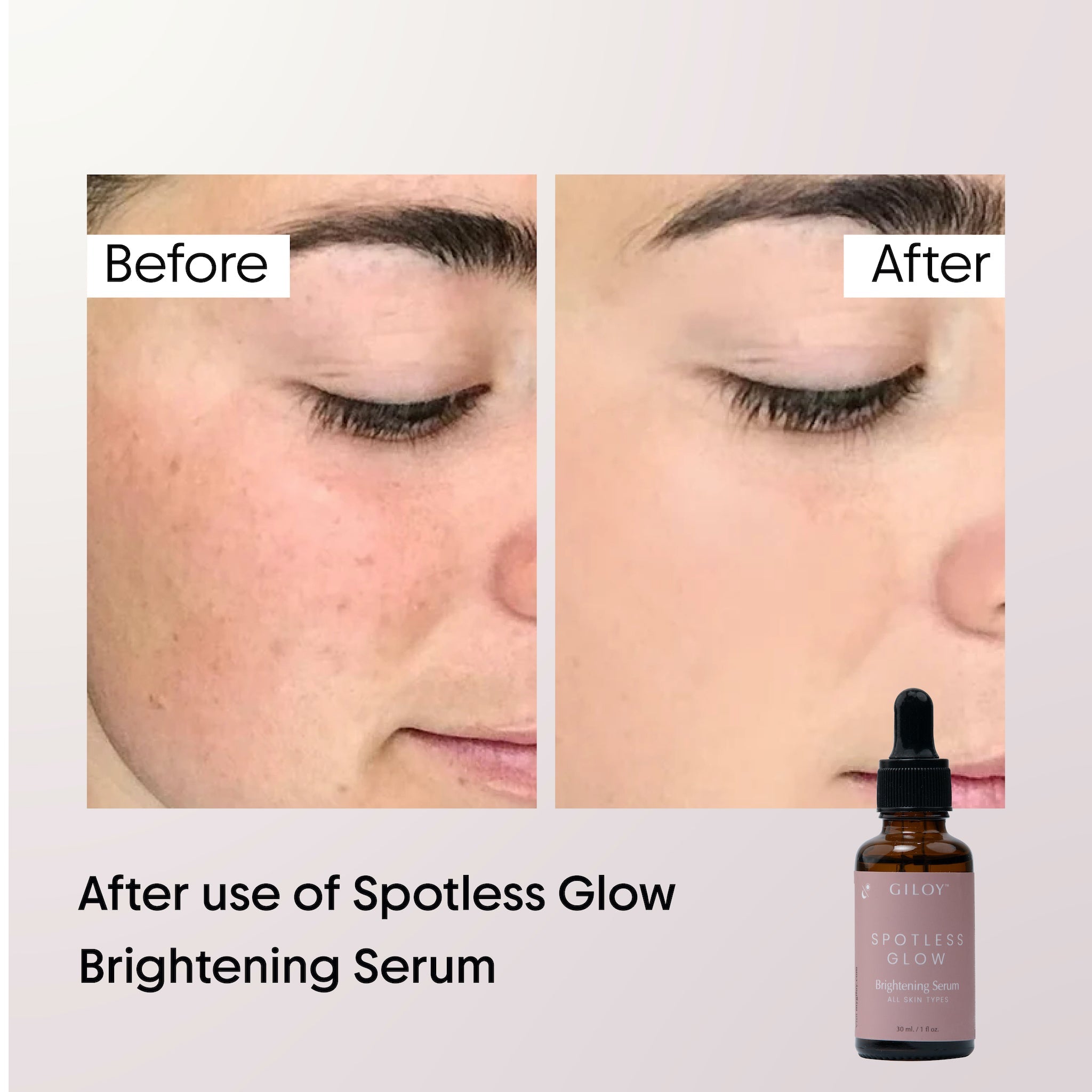 Spotless Glow Brightening Serum