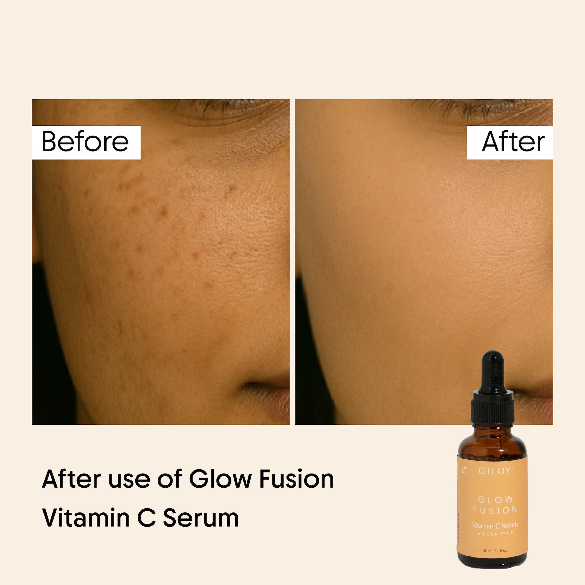 Glow Fusion Vitamin C Serum